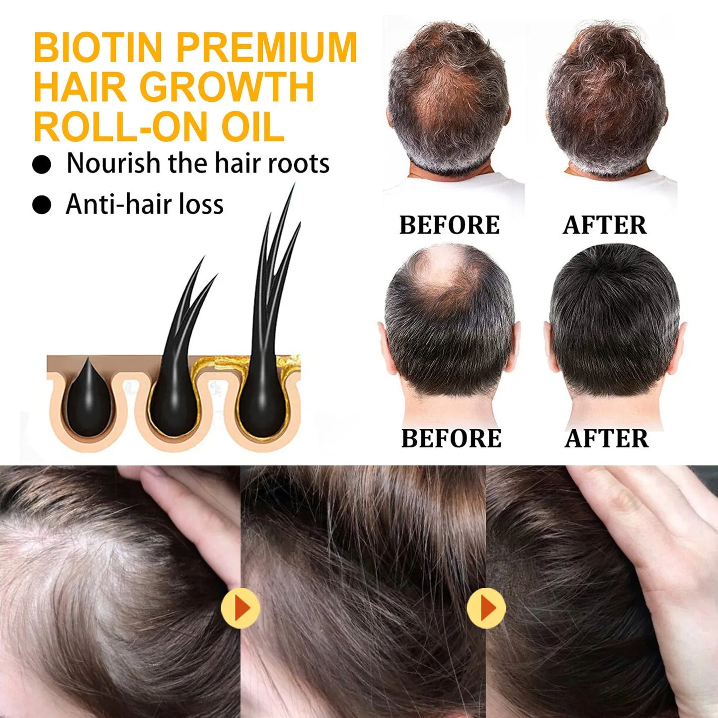 Biotin Fast Hair Growth Products Anti Hair Loss Serum Spray Prevent Baldness Treatment Scalp Beard Beauty Hair Care Product