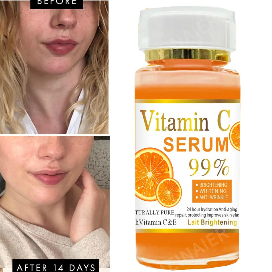 120ml 99% Vitamin C Serum Oil Facial Serum AHA Kojic Acid glutathione Facial skin brightening