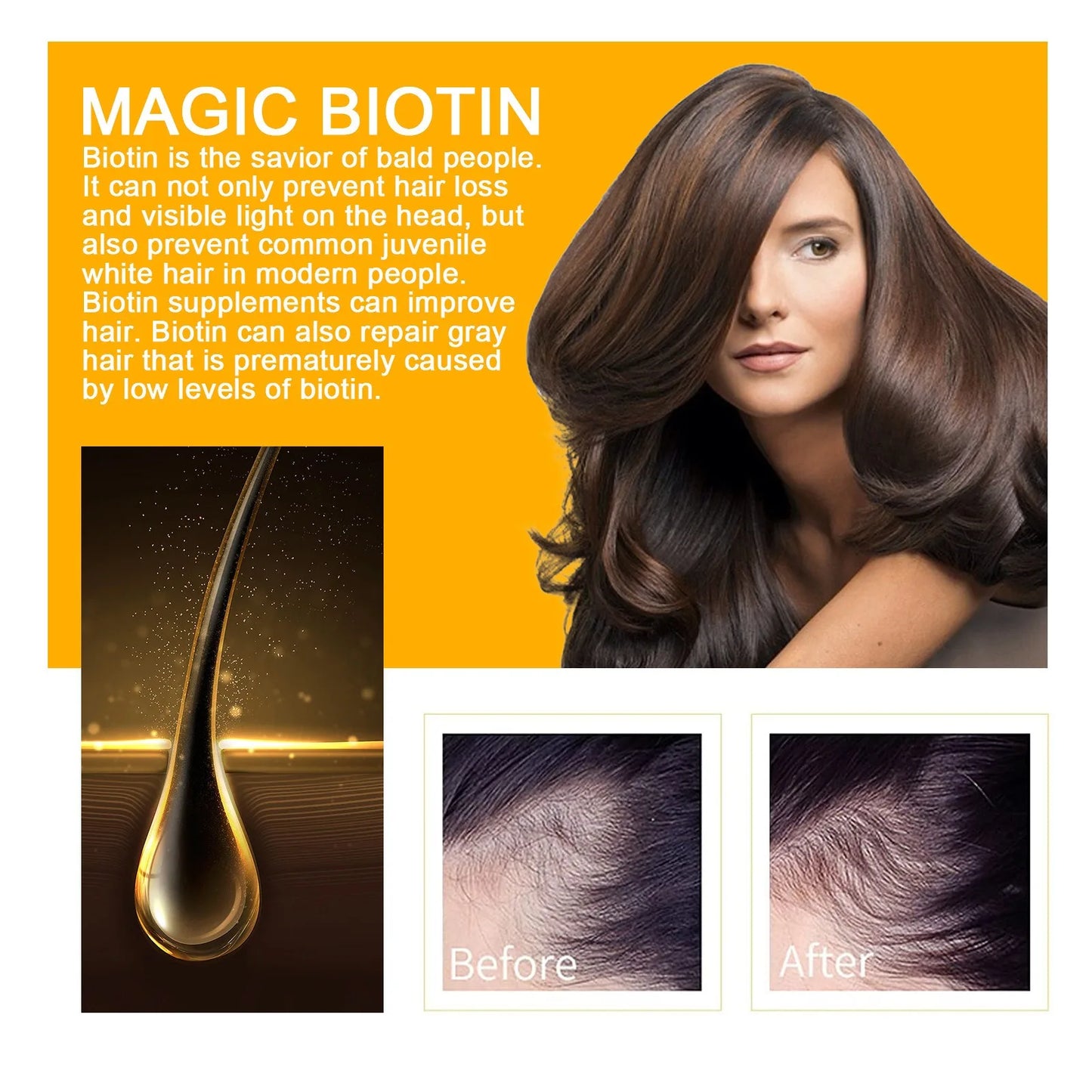 Biotin Fast Hair Growth Products Anti Hair Loss Serum Spray Prevent Baldness Treatment Scalp Beard Beauty Hair Care Product