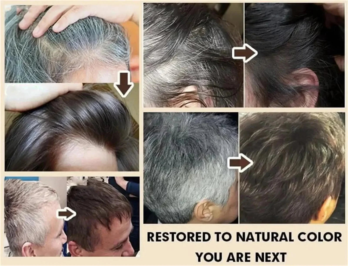 Gray White Hair Treatment Serum Cover White Hair To Black Natural Color Repair Spray Anti Loss Hair Restore Healthy Hair Care