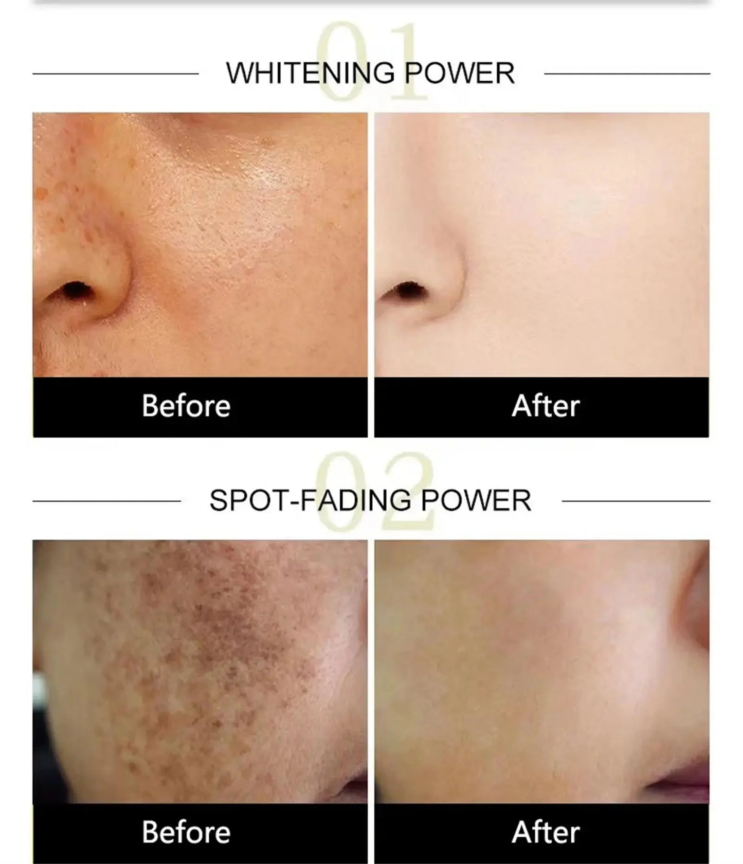 Powerful Dark Spots Remover Whitening Serum Face Freckle Melanin Correcting Anti Pigmentation Brighten Skin Beauty Care Essence