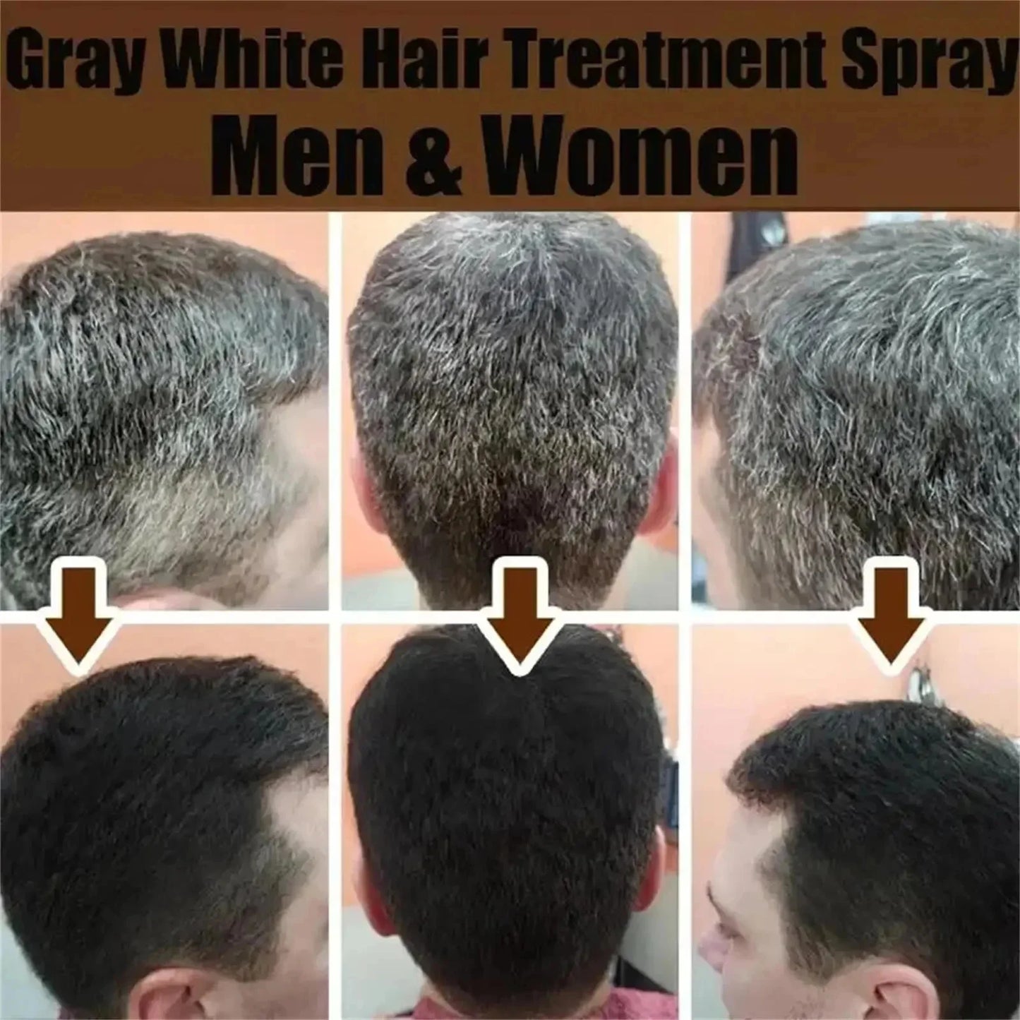 Gray White Hair Treatment Serum Cover White Hair To Black Natural Color Repair Spray Anti Loss Hair Restore Healthy Hair Care