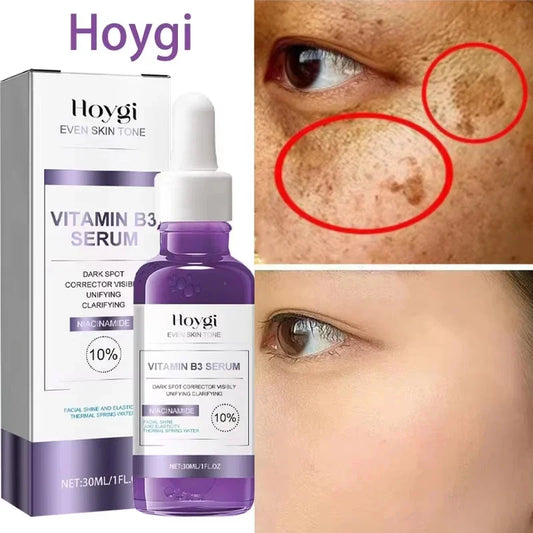 Powerful Dark Spots Remover Whitening Serum Face Freckle Melanin Correcting Anti Pigmentation Brighten Skin Beauty Care Essence